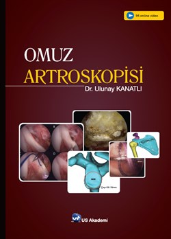 Omuz Artroskopisi 2019